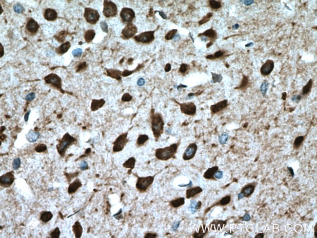 PCP4L1 Antibody in Immunohistochemistry (Paraffin) (IHC (P))
