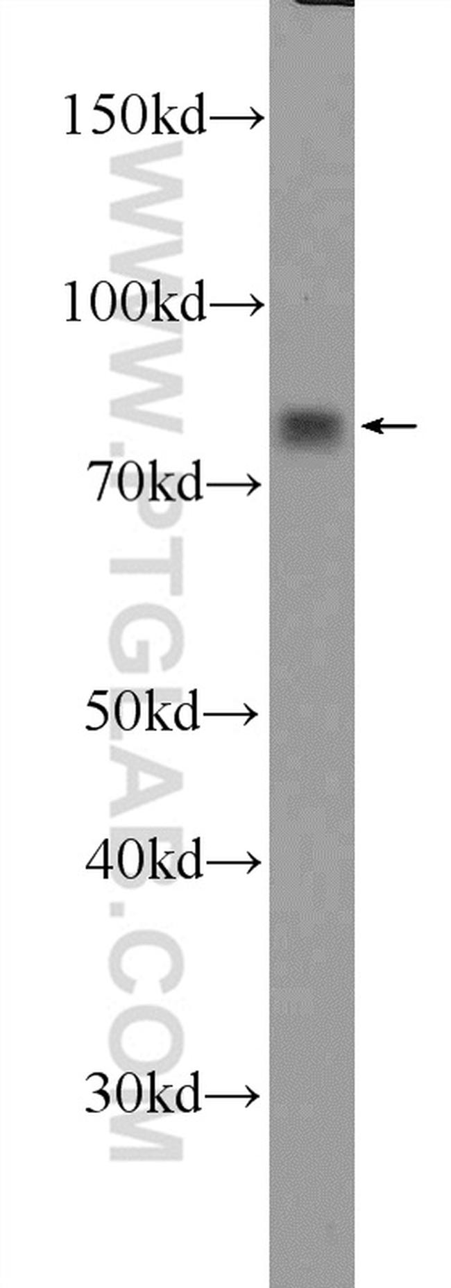 LPPR3 Antibody in Western Blot (WB)