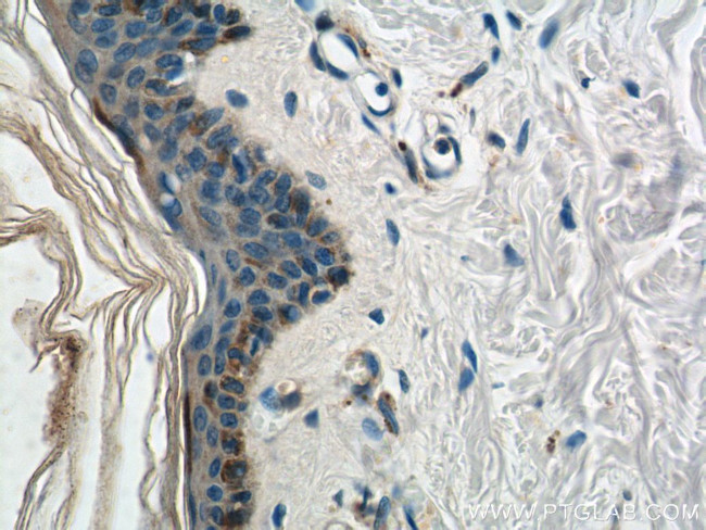 HAL Antibody in Immunohistochemistry (Paraffin) (IHC (P))