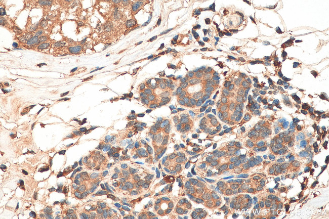 PTPN13 Antibody in Immunohistochemistry (Paraffin) (IHC (P))
