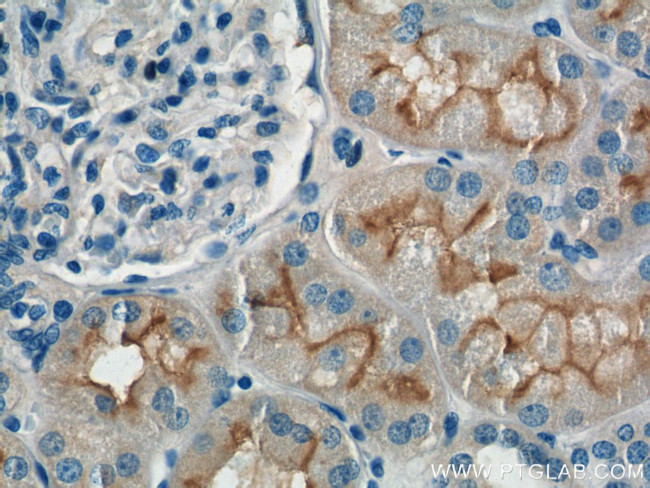 XPNPEP2 Antibody in Immunohistochemistry (Paraffin) (IHC (P))