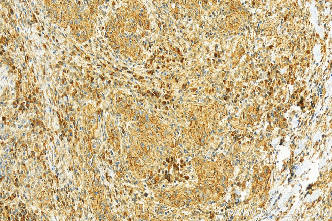 GlyT2 Antibody in Immunohistochemistry (Paraffin) (IHC (P))
