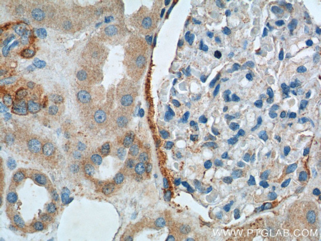 C20orf3 Antibody in Immunohistochemistry (Paraffin) (IHC (P))