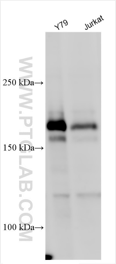 ZNF644 Antibody in Western Blot (WB)