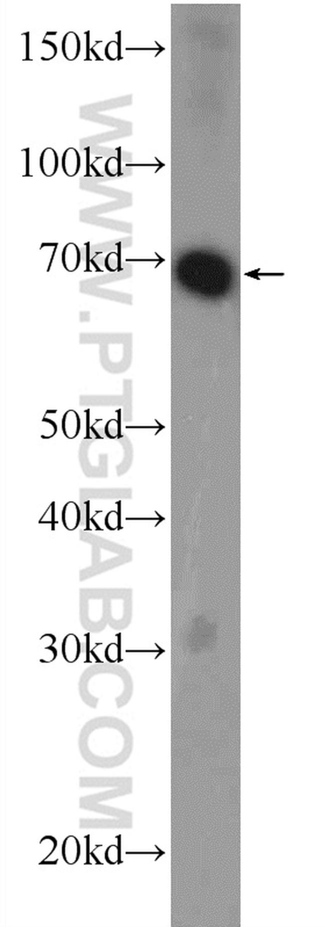 RCOR3 Antibody in Western Blot (WB)