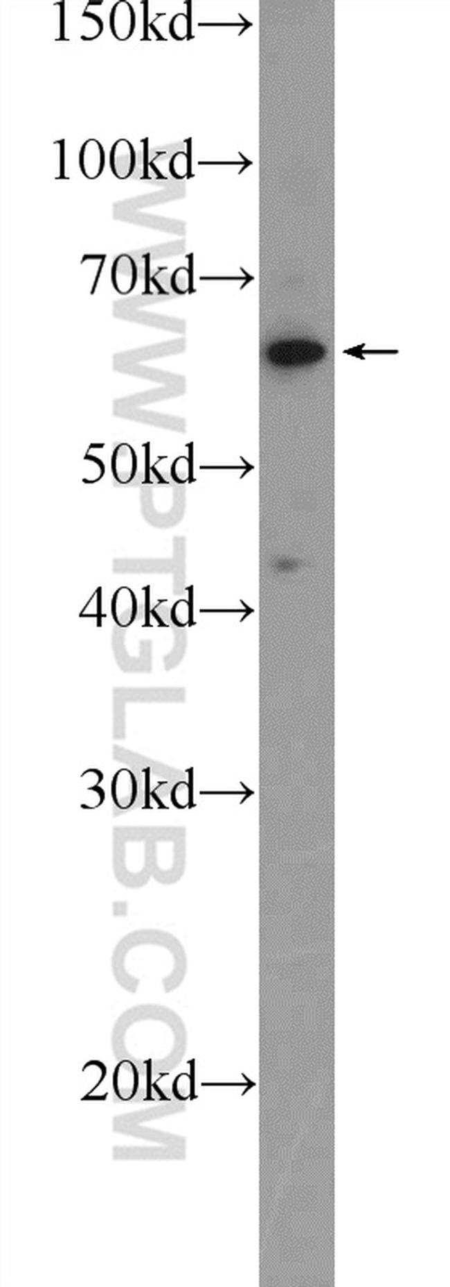 TESPA1 Antibody in Western Blot (WB)