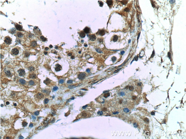 CCDC62 Antibody in Immunohistochemistry (Paraffin) (IHC (P))