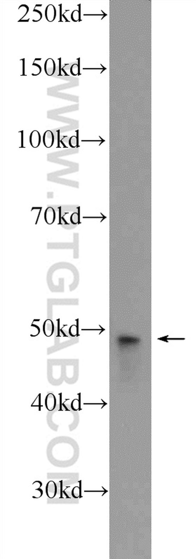 ZDHHC7 Antibody in Western Blot (WB)