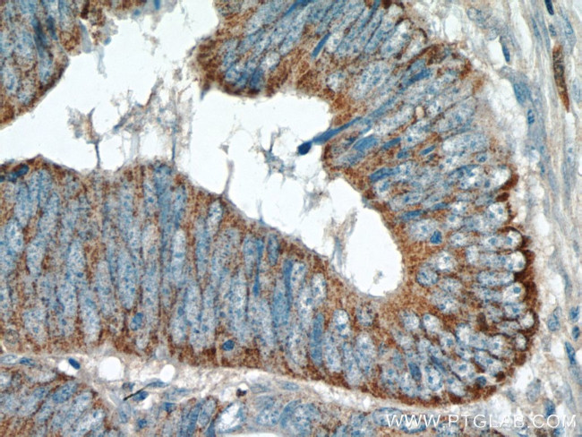 TMEM184A Antibody in Immunohistochemistry (Paraffin) (IHC (P))