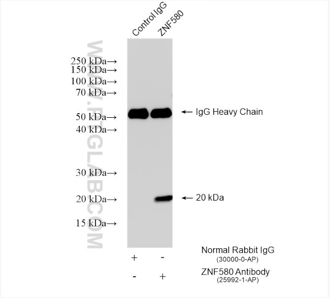 ZNF580 Antibody in Immunoprecipitation (IP)