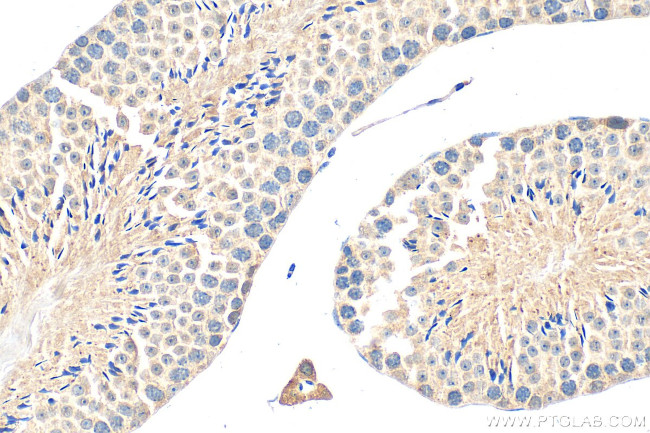 GPR148 Antibody in Immunohistochemistry (Paraffin) (IHC (P))