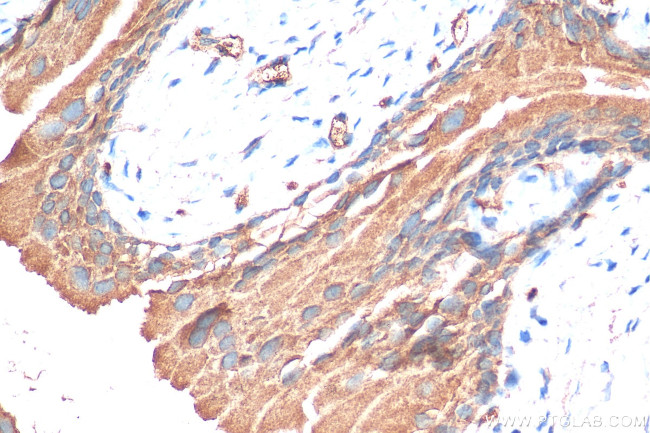 GPR87 Antibody in Immunohistochemistry (Paraffin) (IHC (P))