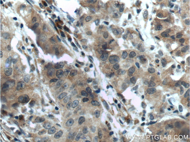 SRD5A1 Antibody in Immunohistochemistry (Paraffin) (IHC (P))