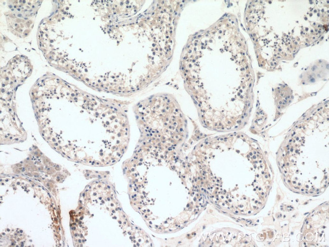 NDUFAF4 Antibody in Immunohistochemistry (Paraffin) (IHC (P))