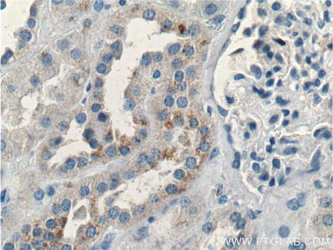 BRAP Antibody in Immunohistochemistry (Paraffin) (IHC (P))