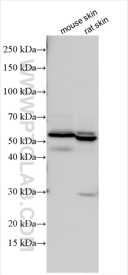KRT86 Antibody in Western Blot (WB)