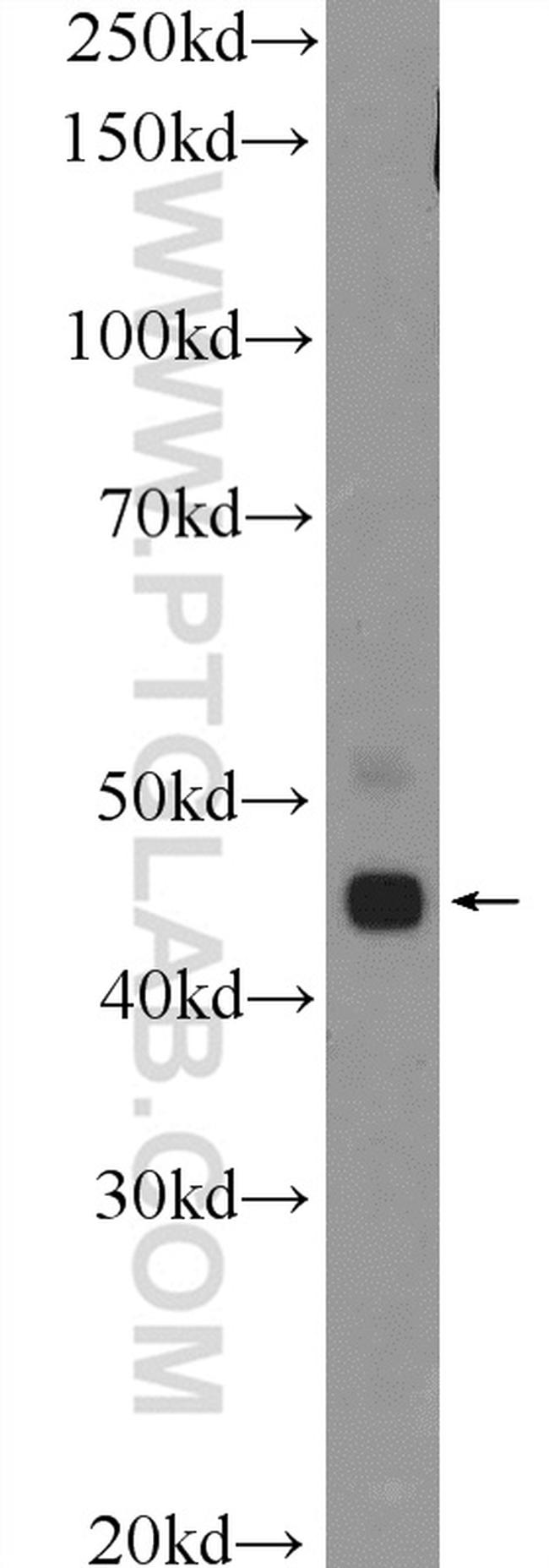 TTLL10 Antibody in Western Blot (WB)