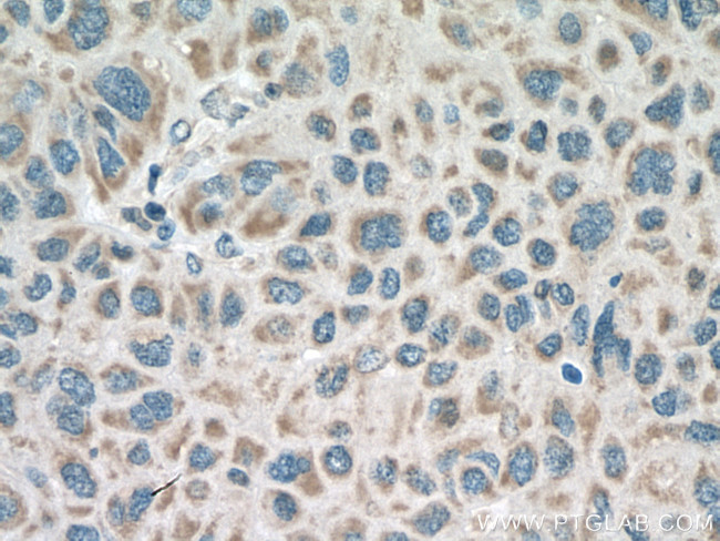 RNF128 Antibody in Immunohistochemistry (Paraffin) (IHC (P))