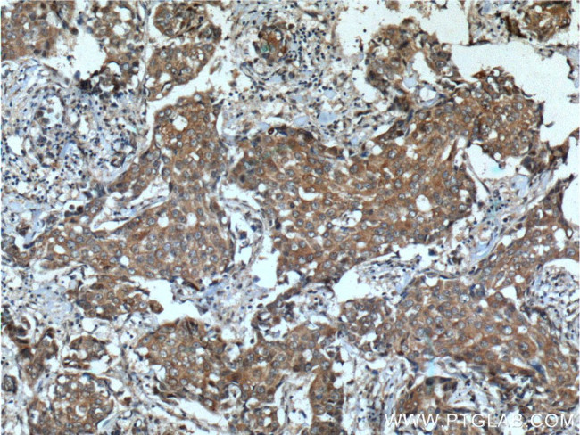 KIAA0090 Antibody in Immunohistochemistry (Paraffin) (IHC (P))
