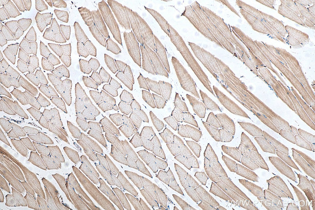 DHRS7C Antibody in Immunohistochemistry (Paraffin) (IHC (P))