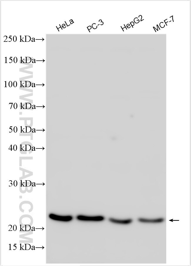 ZCCHC13 Antibody in Western Blot (WB)