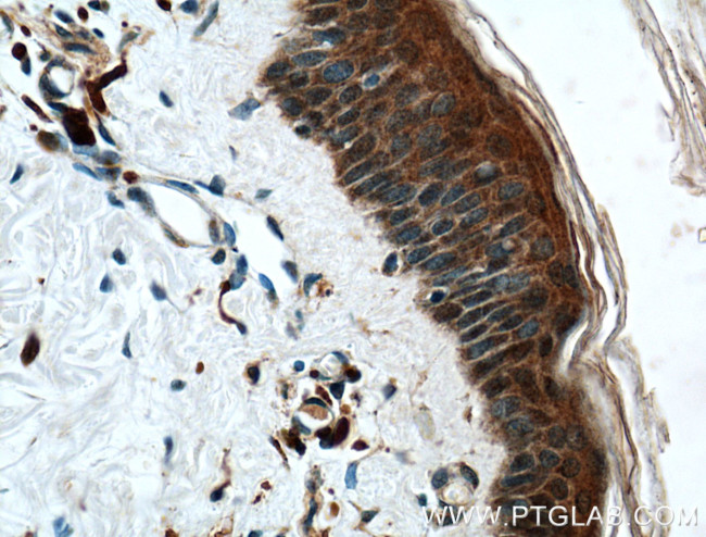 CHRNA9 Antibody in Immunohistochemistry (Paraffin) (IHC (P))