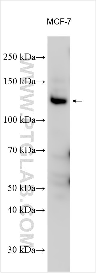 FAM83B Antibody in Western Blot (WB)