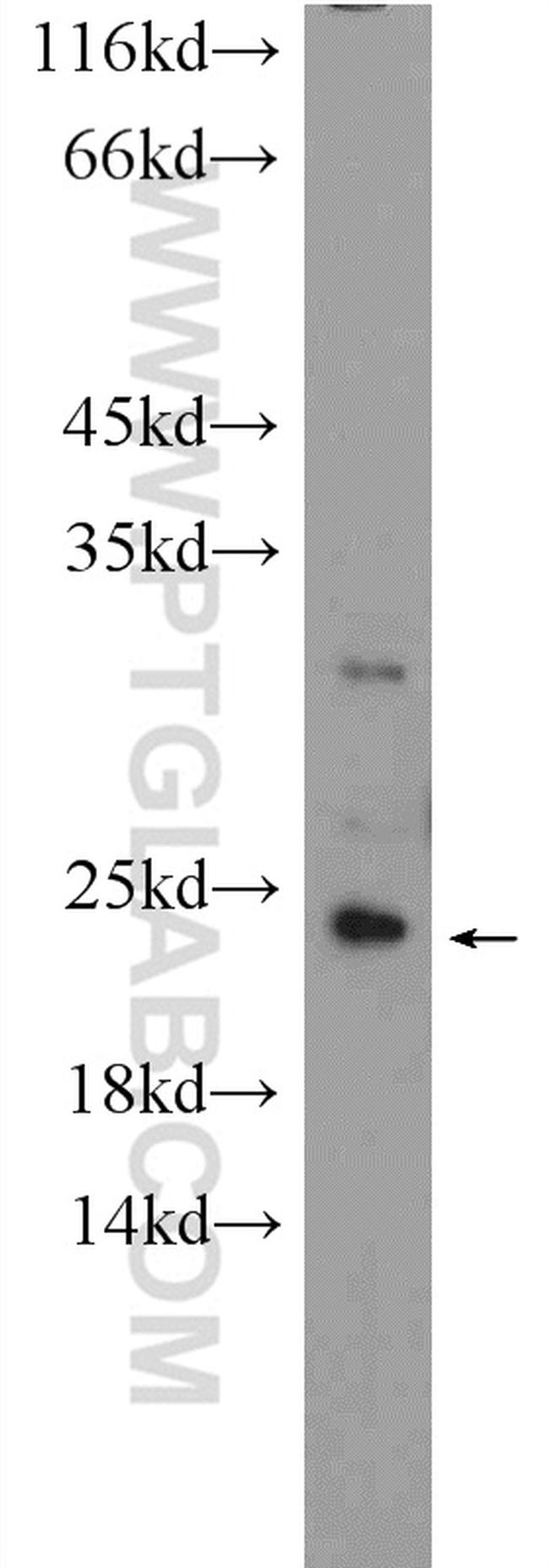 C3orf34 Antibody in Western Blot (WB)
