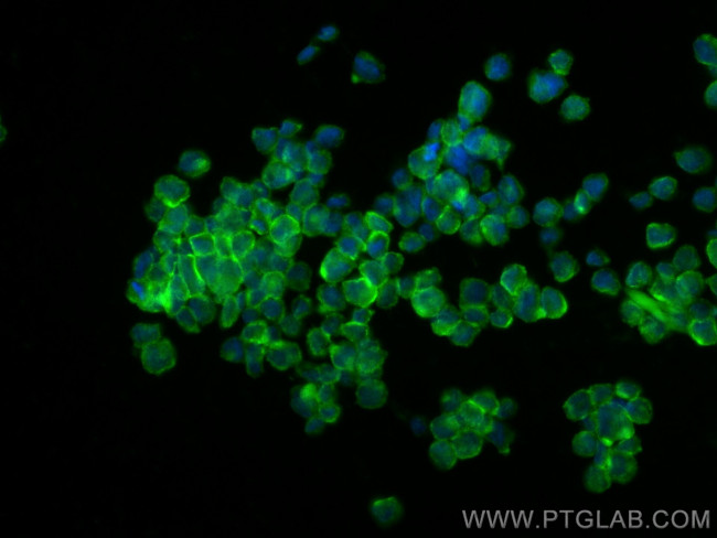 MLC1 Antibody in Immunocytochemistry (ICC/IF)