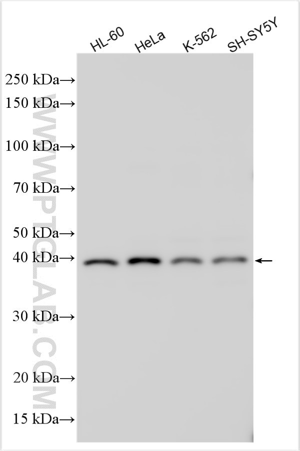 RTN4RL2 Antibody in Western Blot (WB)
