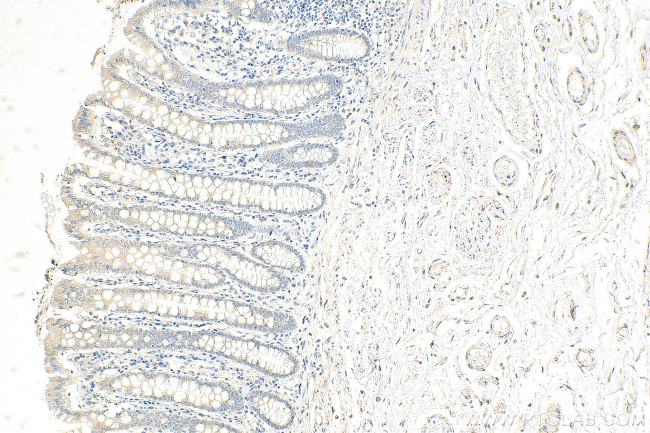 RNF141 Antibody in Immunohistochemistry (Paraffin) (IHC (P))