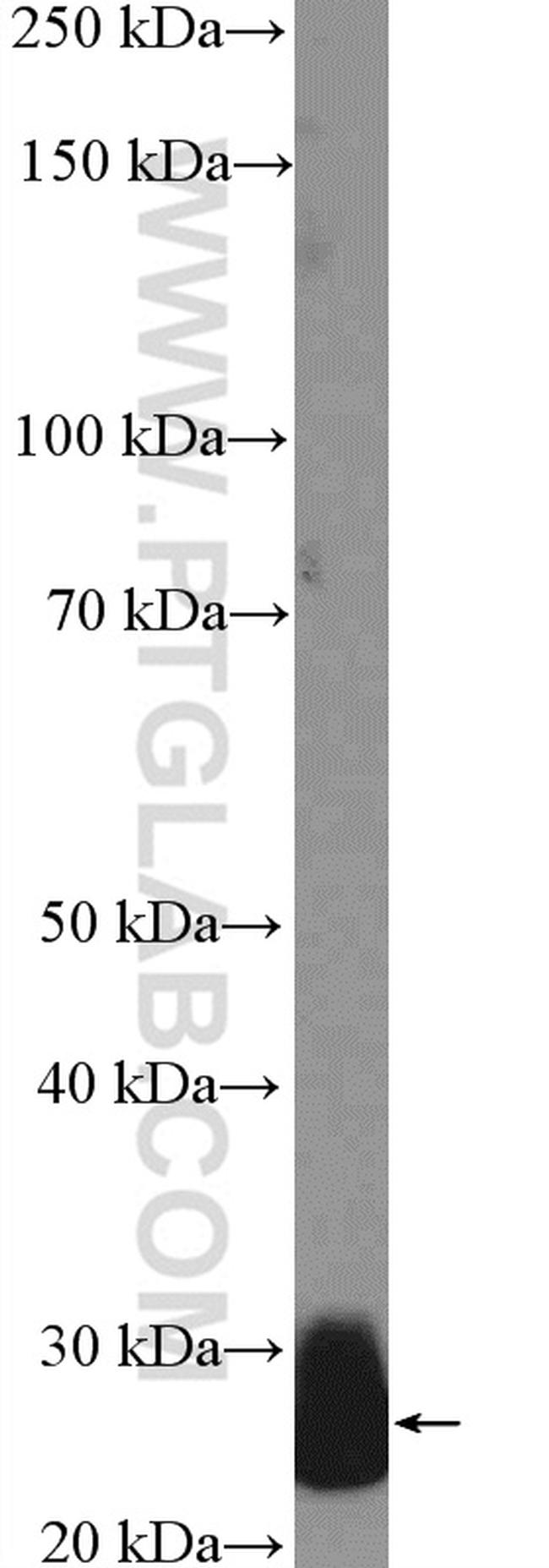 CFD Antibody in Western Blot (WB)