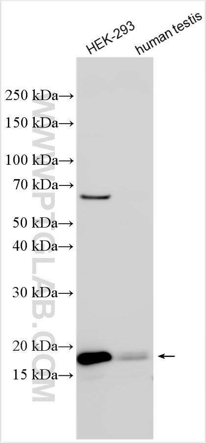 TSEN15 Antibody in Western Blot (WB)