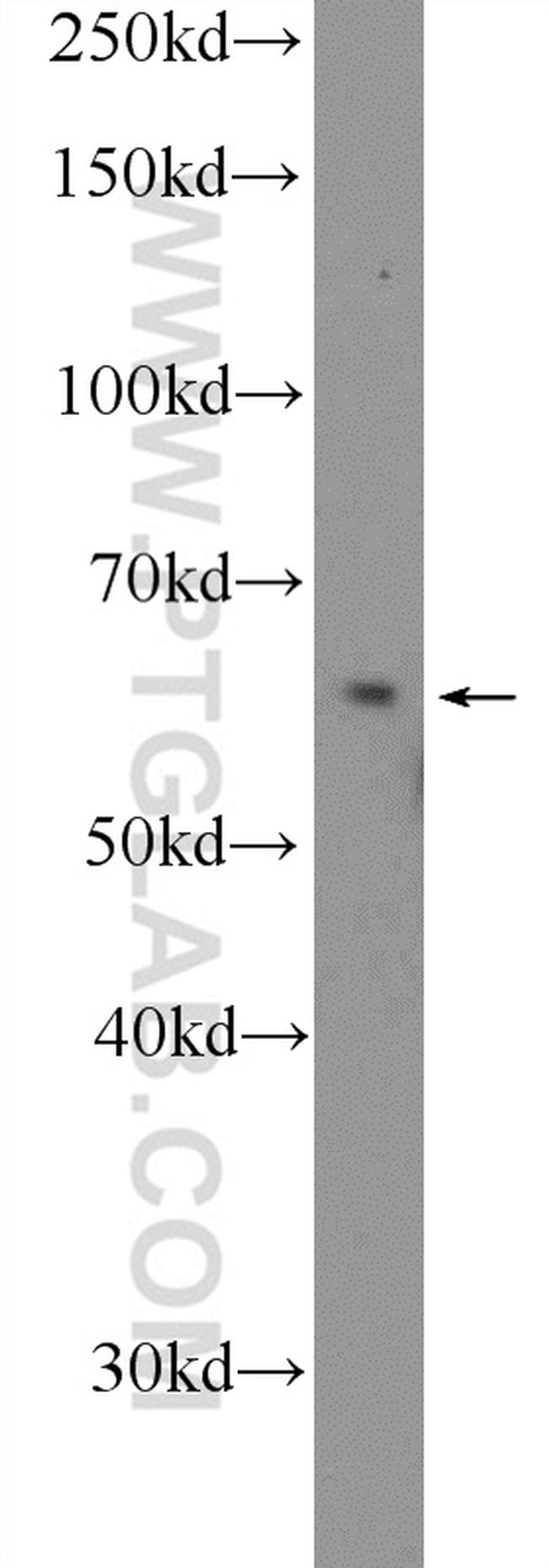 ITPRIP Antibody in Western Blot (WB)