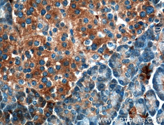 UBXN10 Antibody in Immunohistochemistry (Paraffin) (IHC (P))