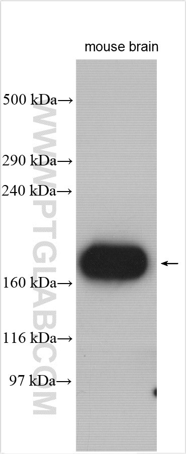 LRRIQ1 Antibody in Western Blot (WB)