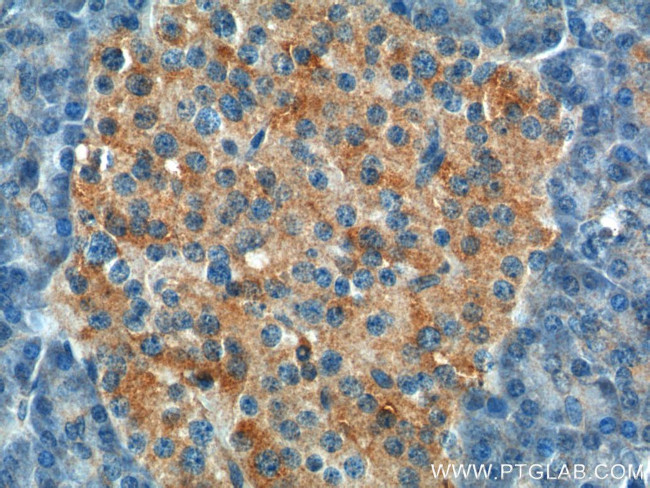 UBR1 Antibody in Immunohistochemistry (Paraffin) (IHC (P))