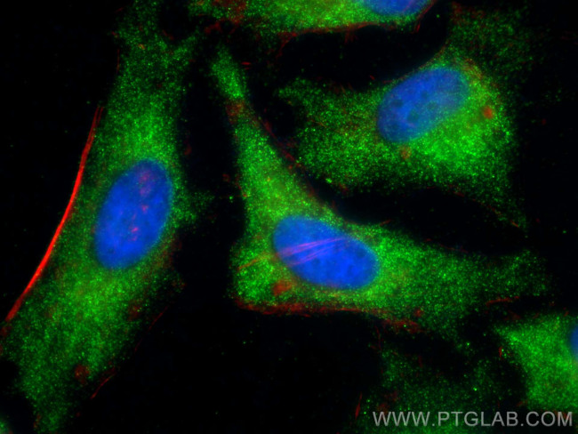 DUSP6 Antibody in Immunocytochemistry (ICC/IF)