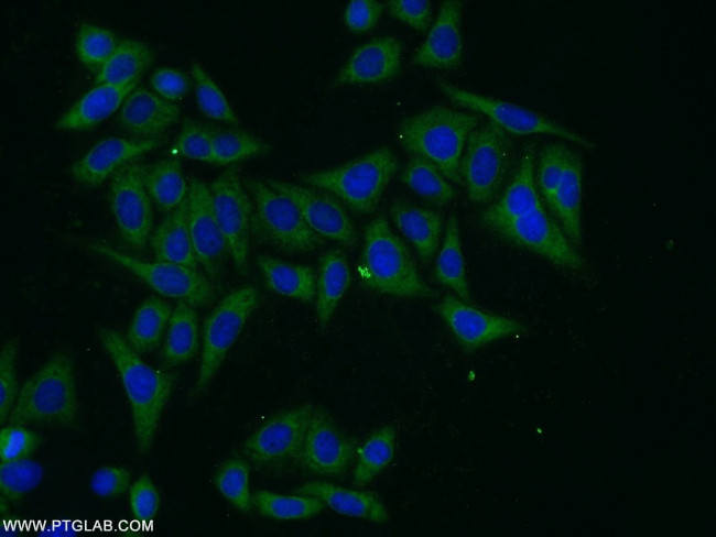 PARP10 Antibody in Immunocytochemistry (ICC/IF)