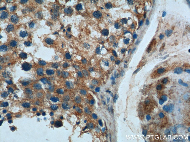 C1orf9 Antibody in Immunohistochemistry (Paraffin) (IHC (P))