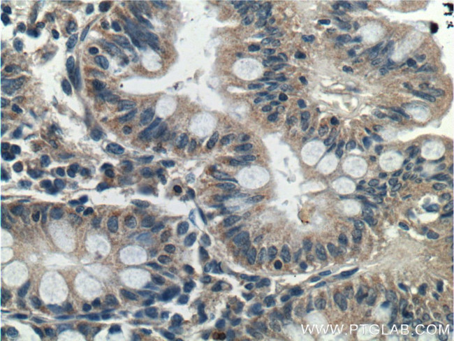 C12orf69 Antibody in Immunohistochemistry (Paraffin) (IHC (P))
