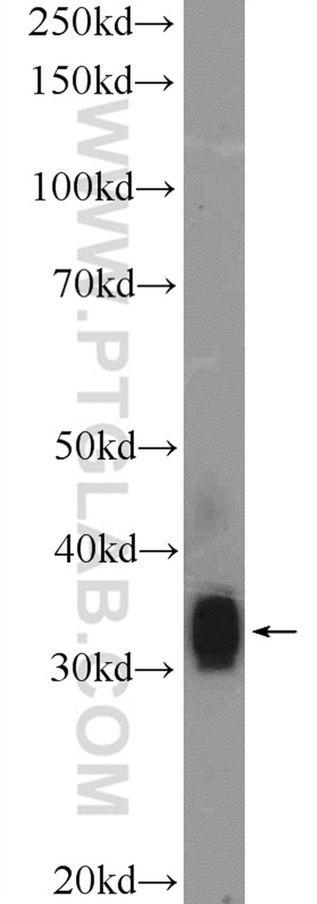 FLJ25006 Antibody in Western Blot (WB)