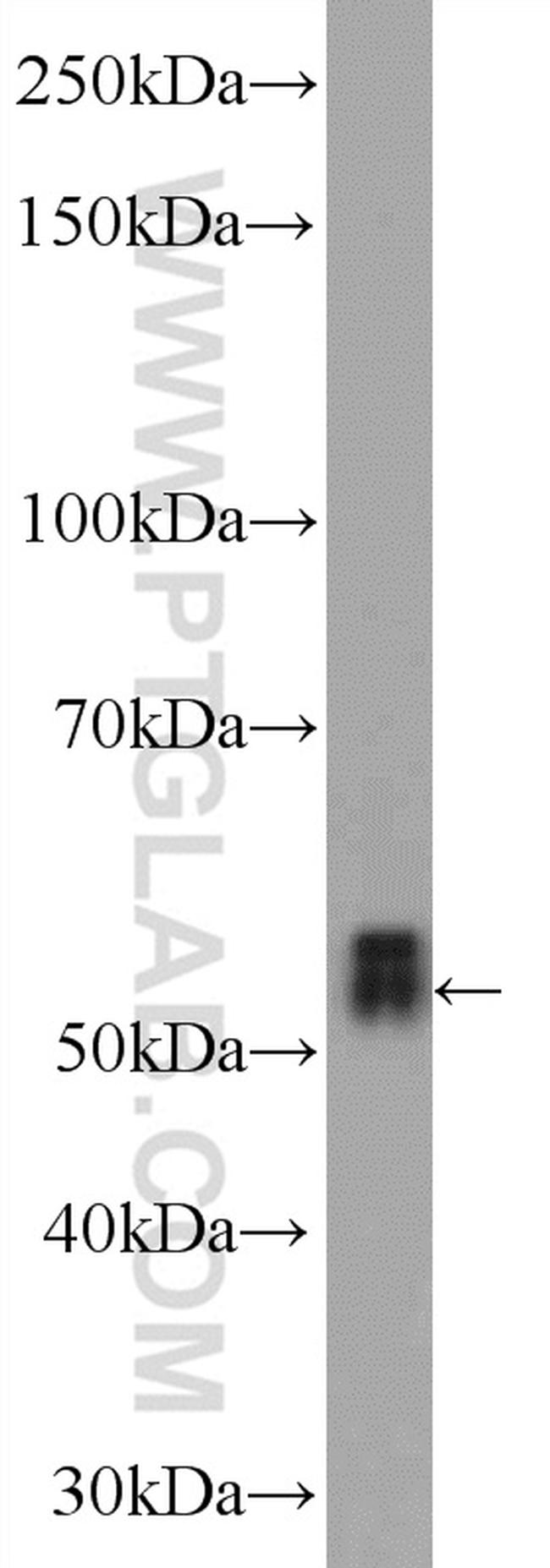 TEKT5 Antibody in Western Blot (WB)