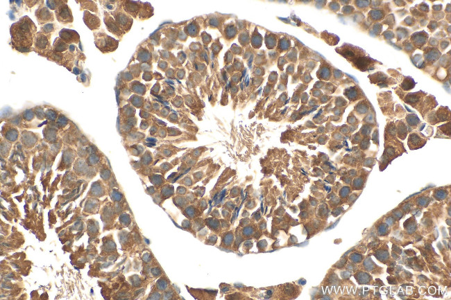 RIMKLB Antibody in Immunohistochemistry (Paraffin) (IHC (P))