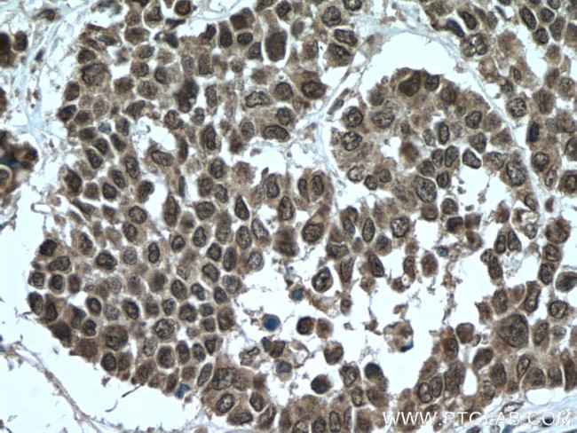 TTC5 Antibody in Immunohistochemistry (Paraffin) (IHC (P))