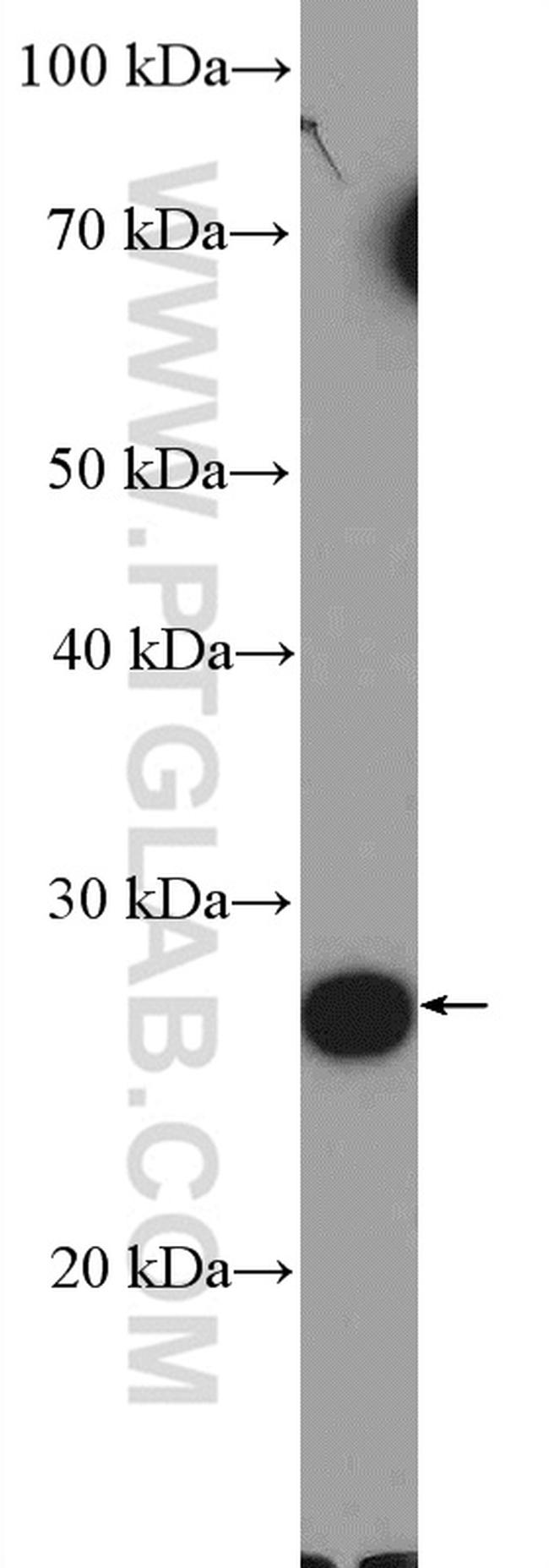 C19orf20 Antibody in Western Blot (WB)
