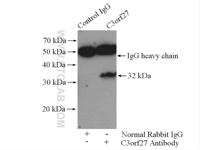 C3orf27 Antibody in Immunoprecipitation (IP)