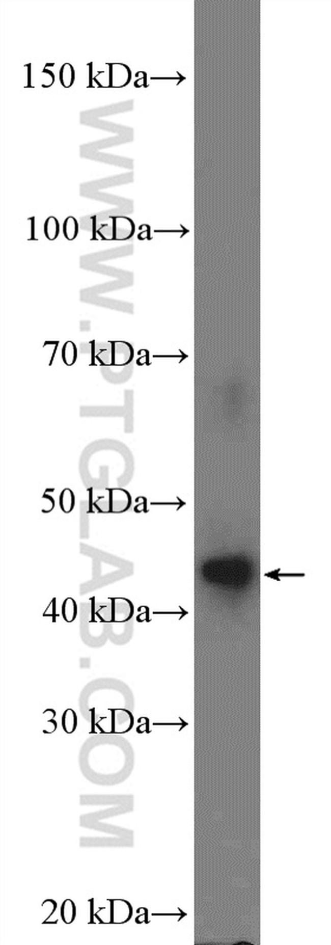 DMRTB1 Antibody in Western Blot (WB)