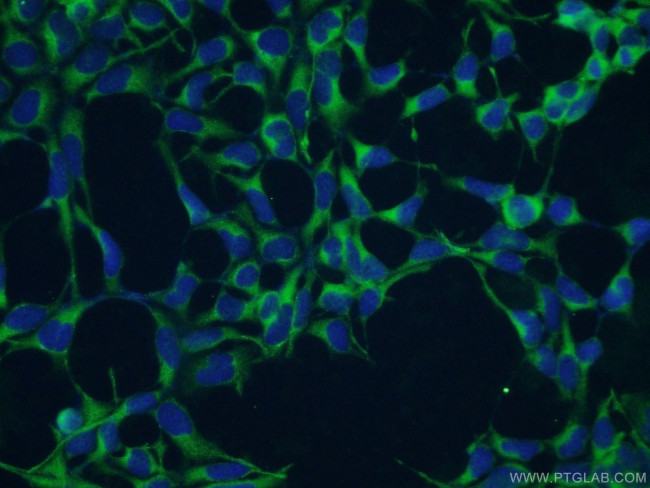 GHDC Antibody in Immunocytochemistry (ICC/IF)