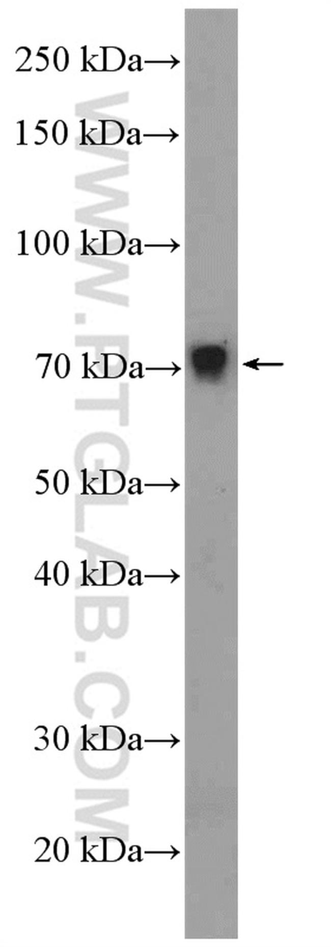 ZNF606 Antibody in Western Blot (WB)